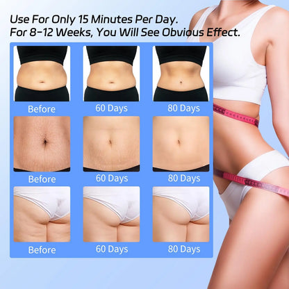 Electric Vacuum  Anti-Cellulite Therapy Massager